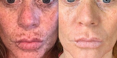 People are calling this $23 dark spot correcting serum a 'miracle worker'