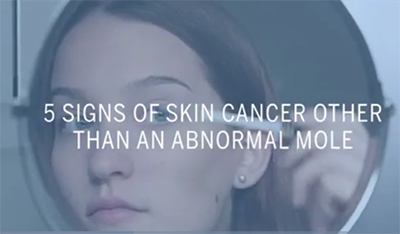 Here’s What you Need to Know About the 3 Types of Skin Cancer