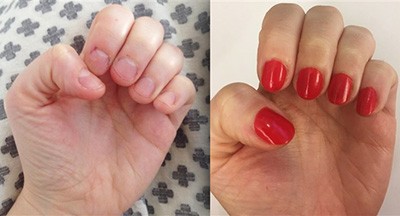 This polish helped thousands of users stop biting their nails