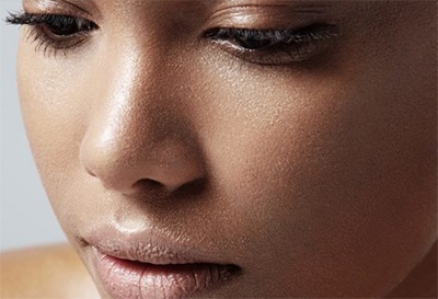 Dermatologists’ Top Tips for Oily Skin