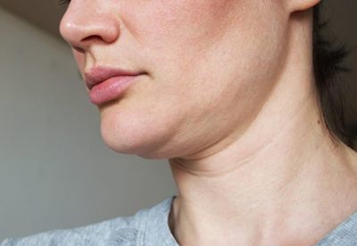 How to Get Rid of a Double Chin: What Really Works