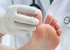 How to tell when you have athlete's foot and what to do about it