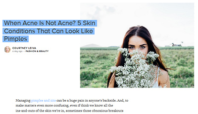 When Acne Is Not Acne? 5 Skin Conditions That Can Look Like Pimples