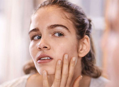 Probiotics the Answer to Acne