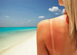 Can You Get Skin Cancer From Just One Sunburn?