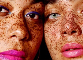 Ever wonder what causes freckles? Here’s how they form